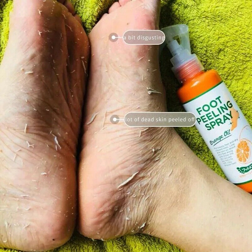 110ML Foot Cuticle Remover & Exfoliator